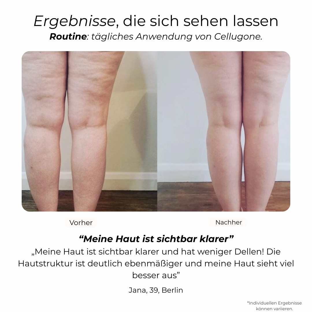 Cellugone 3.0 – Dein Selfcare-Massage Gerät