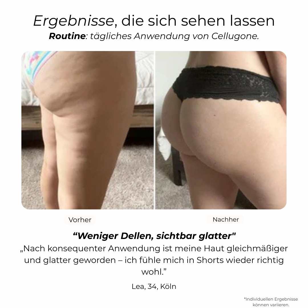 Cellugone 3.0 – Dein Selfcare-Massage Gerät